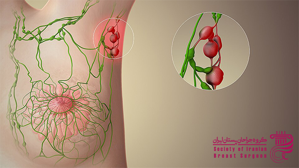 تورم غده لنفاوی چیست