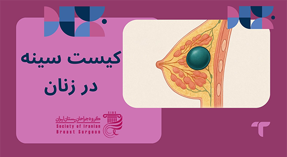 علت کیست سینه چیست