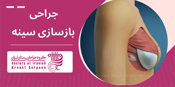 چه کسانی کاندید جراحی بازسازی سینه هستند