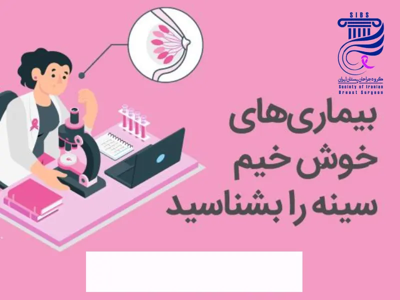 بیماری توده خوش_خیم پستان