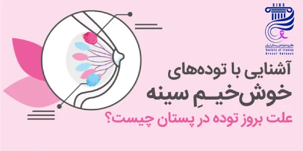 تودههای خوشخیم سینه و درمان آنها