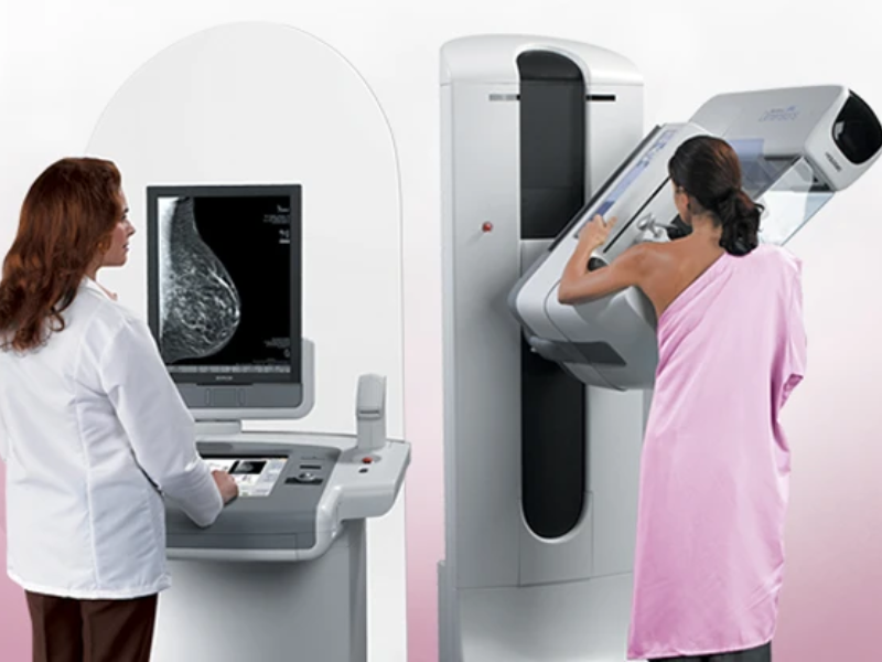 ماموگرافی چیست