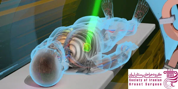 پرتودرمانی در سرطان پستان