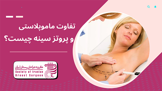 تفاوت ماموپلاستی و پروتز سینه چیست؟
