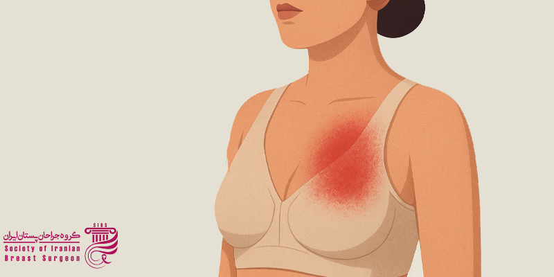 آمبولی بعد از ماموپلاستی