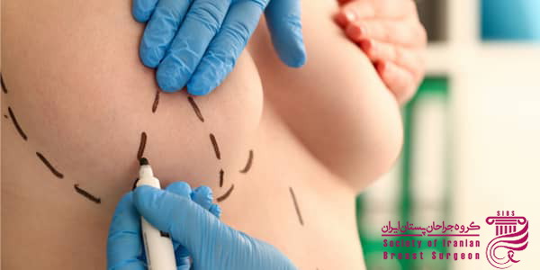 علت بی حس شدن سینه بعد از ماموپلاستی