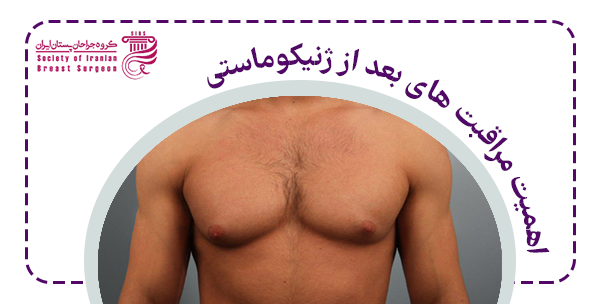 اهمیت مراقبت های ژنیکوماستی