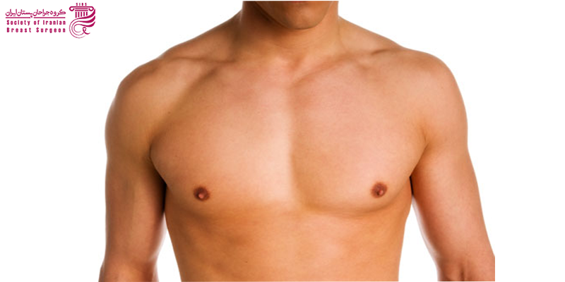 جراحی ژنیکوماستی