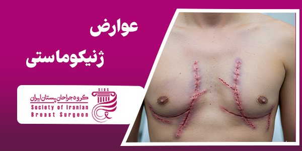 عوارض ژنیکوماستی چیا هستن