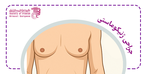مراحل جراحی ژنیکوماستی