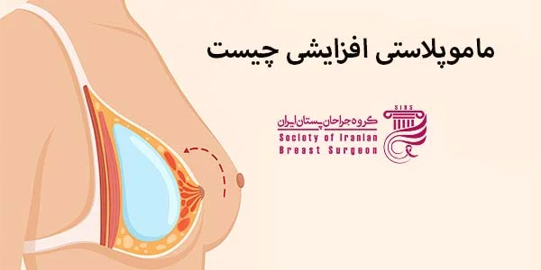 کاندید ماموپلاستی افزایشی چه کسانی هستند