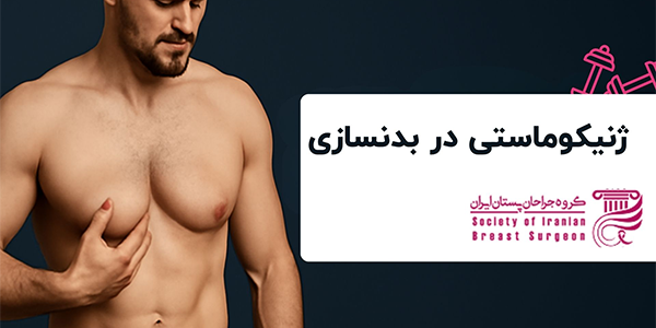 درمان ژنیکوماستی در بدنسازی