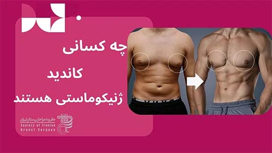 چه کسانی کاندید زنیکوماستی هستند