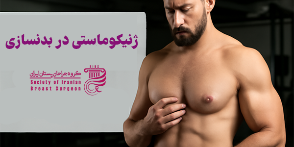 ژنیکوماستی در بدنسازی چیست