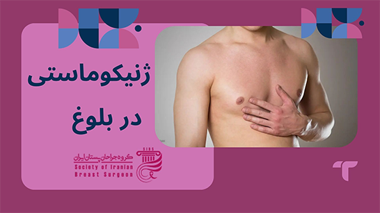 هزینه ژنیکوماستی در بلوغ