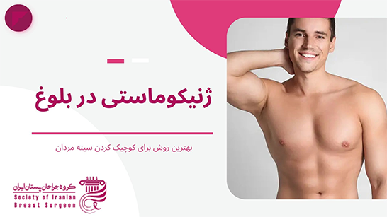 ژنیکوماستی در بلوغ چگونه است