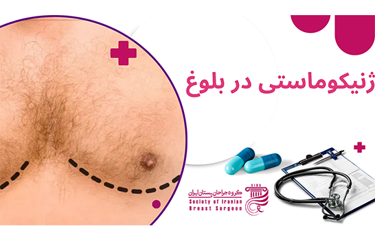 ژنیکوماستی در بلوغ چیست